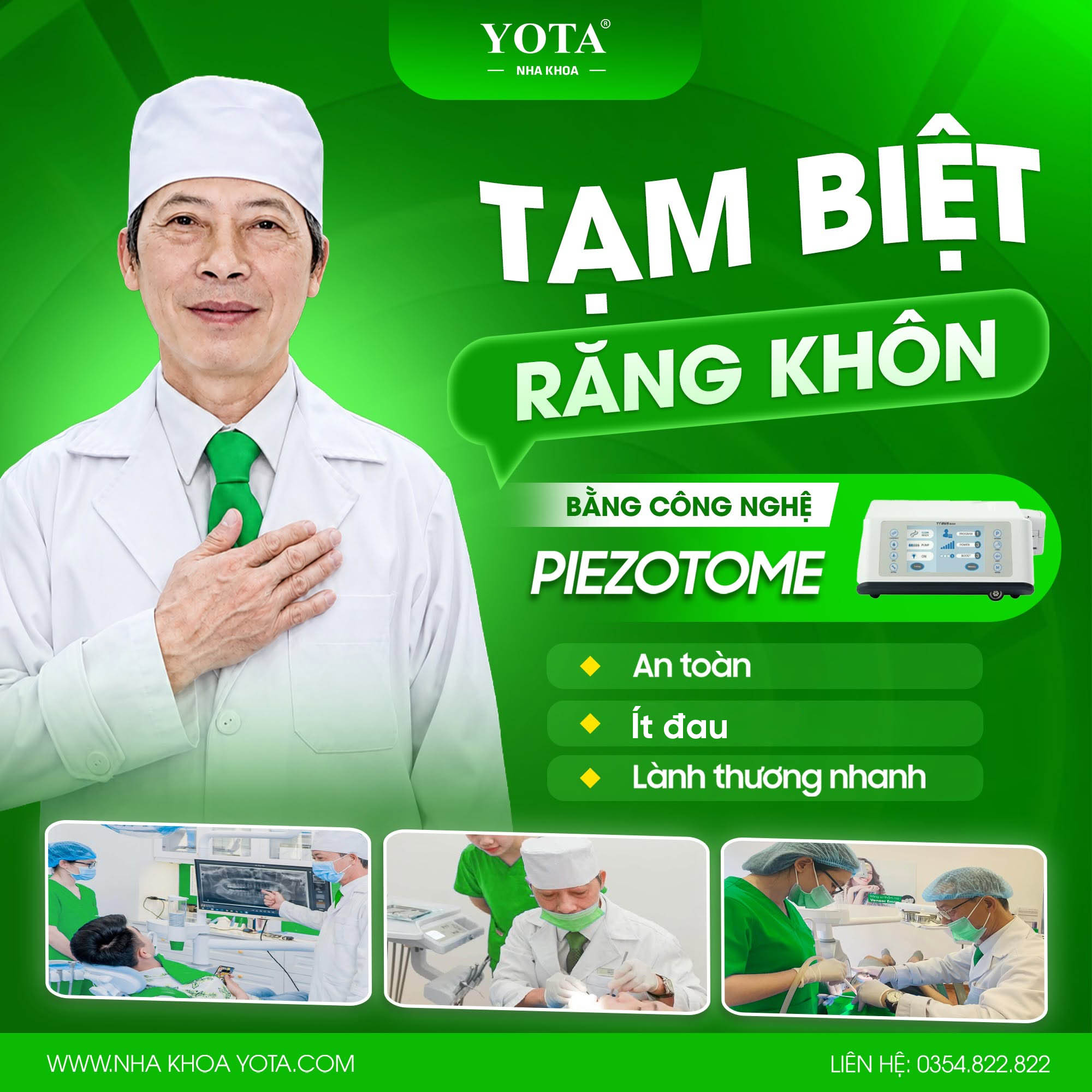 nhổ răng khôn ảnh 3