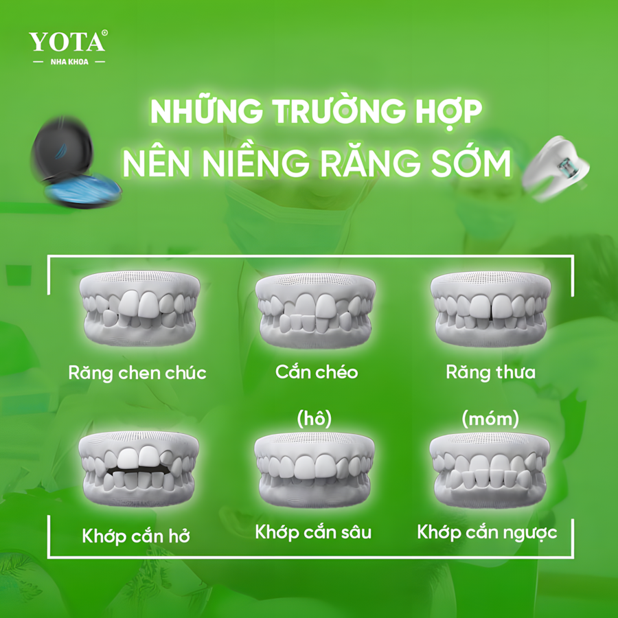 niềng răng ảnh 1