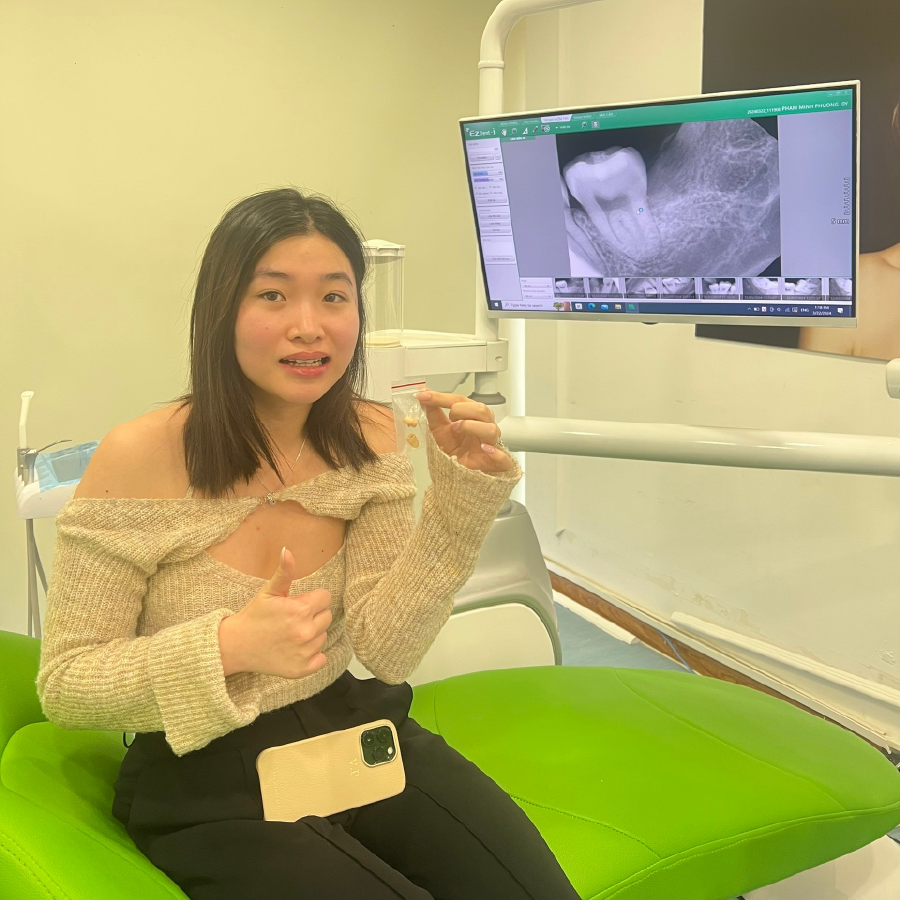 cảm nhận nhổ răng khôn