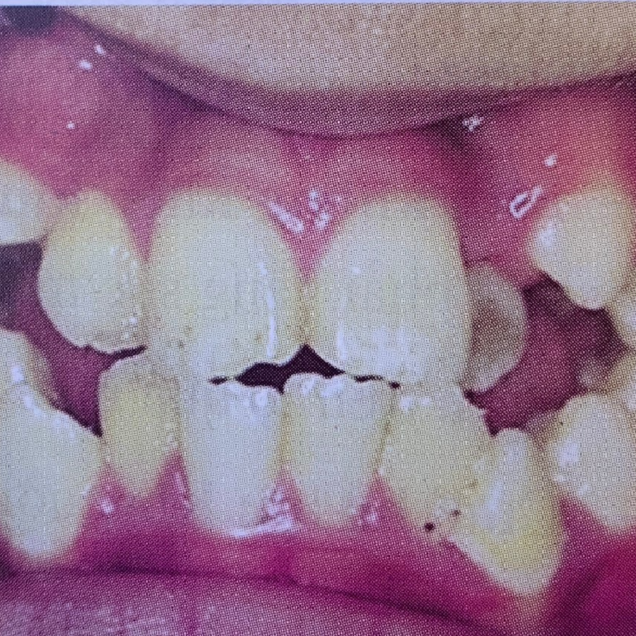 thói quen thở bằng miệng ảnh 3